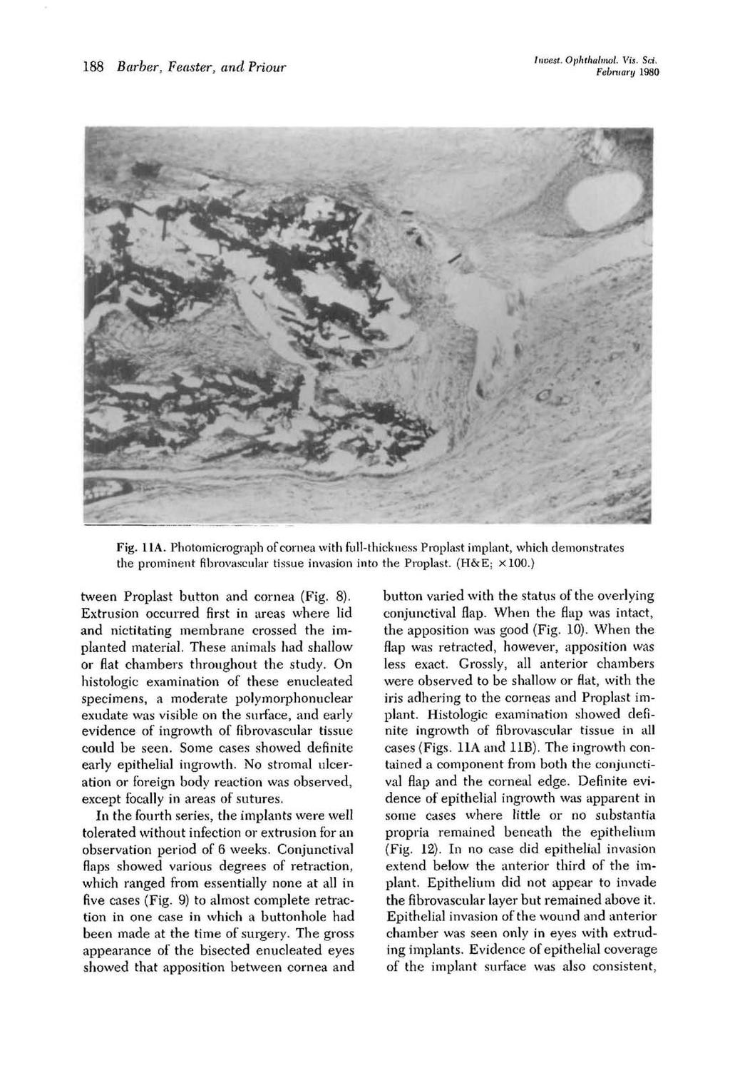 188 Barber, Feasier, and Priour Invest. Ophthalmol. Vis. Sci. February 1980 Fig. 11A.