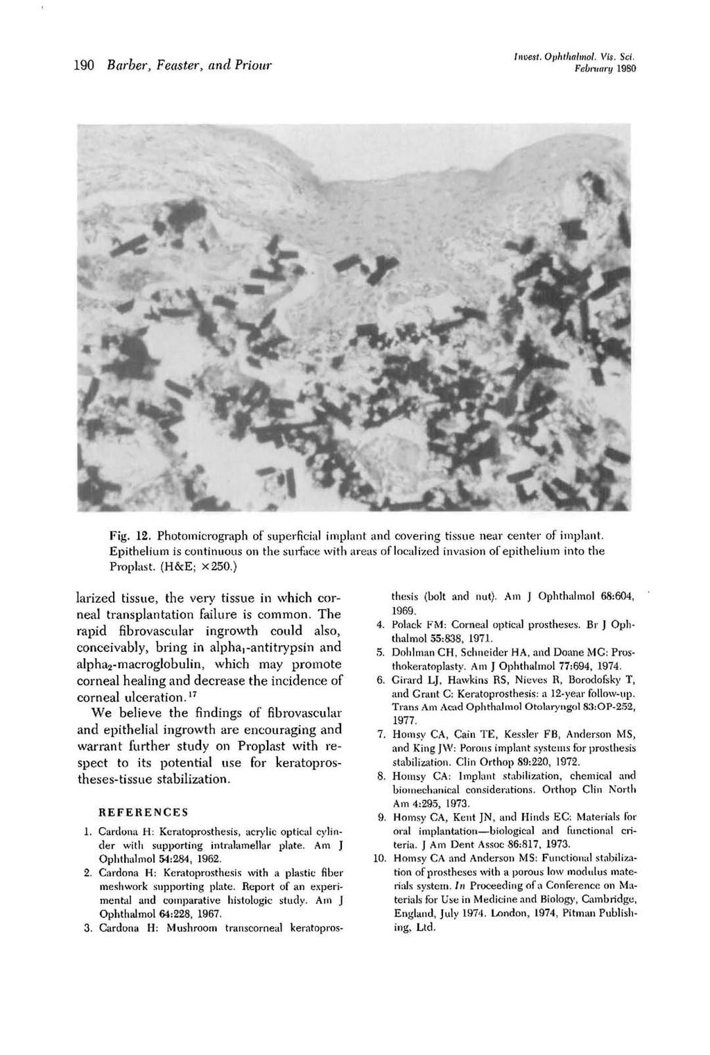 190 Barber, Feaster, and Friour Invest. Ophthalmol. Vis. Sci. February 1980 Fig. 12. Photomicrograph of superficial implant and covering tissue near center of implant.