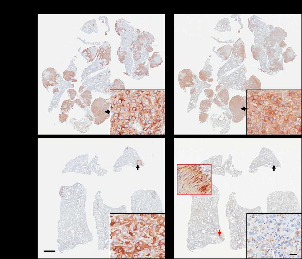 Supplementary Figure 3. Immunohistochemical staining of LPP and ErbB2 in lung metastases.