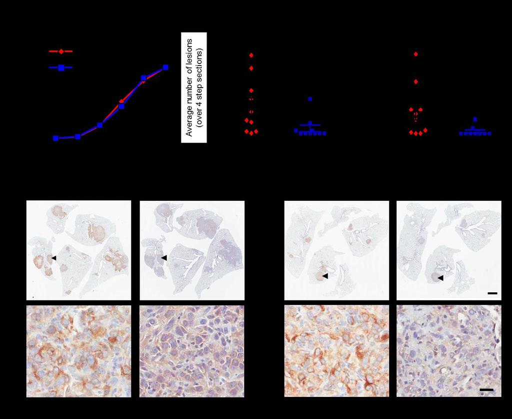 Supplementary Figure 9. Dox-inducible loss of LPP expression impairs lung metastasis formation.