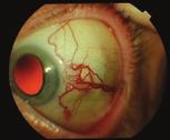 Important clinical decisions must be made about the appearance of the lesion, the likely diagnosis and whether to monitor or refer for a second opinion.