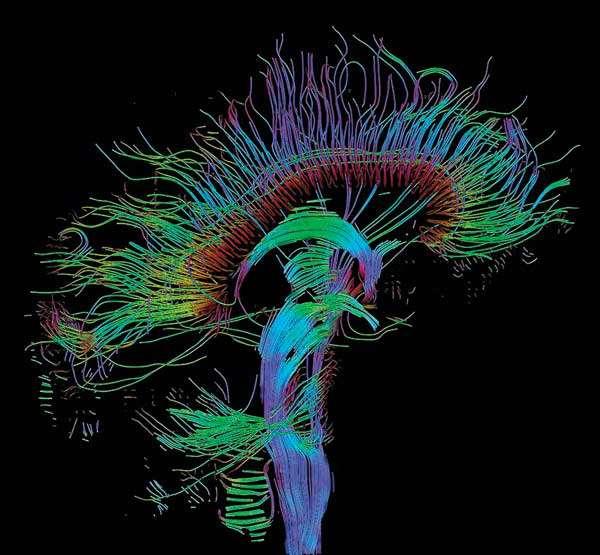 The Human Brain Nerve tracks
