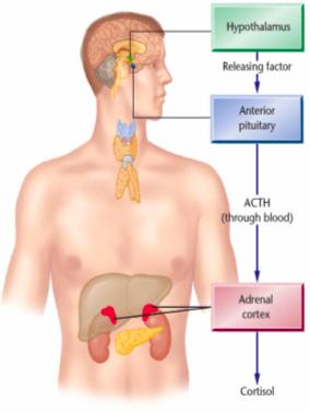 Stress Hormone Hypothalamus Stress Anterior pitutiary Secete Releasing factor Adrenal cortex ACTH released into dlood Cortisol (a member of glucocorticoids) Exposure to Chronic stress 1.