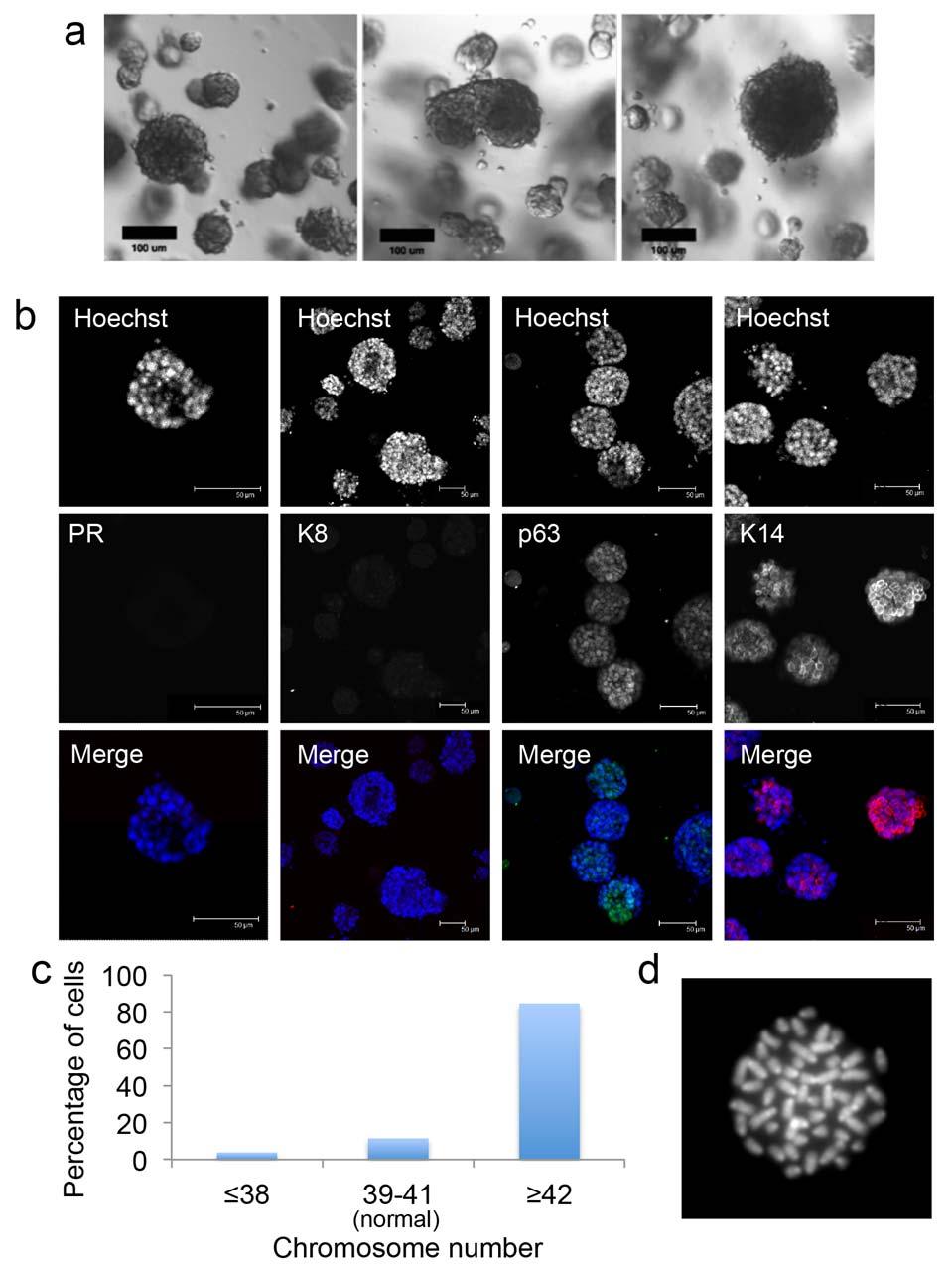 79 80 81 82 83 84 85 86 87 88 89 90 91 92 Supplementary Figure 10: Long-term culture of mammary organoids with EGF and high concentrations of R-spondin 1 is associated with chromosomal abnormalities.
