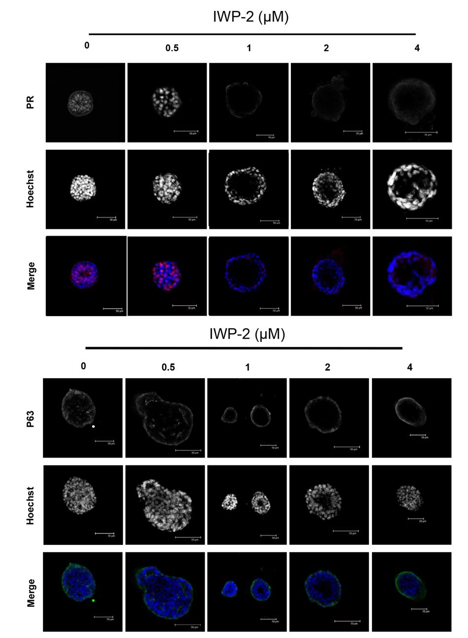 206 207 208 209 210 211 212 213 214 215 Supplementary Figure 21: The Wnt signalling inhibitor IWP-2 induces loss of expression of PR in mammary organoids.
