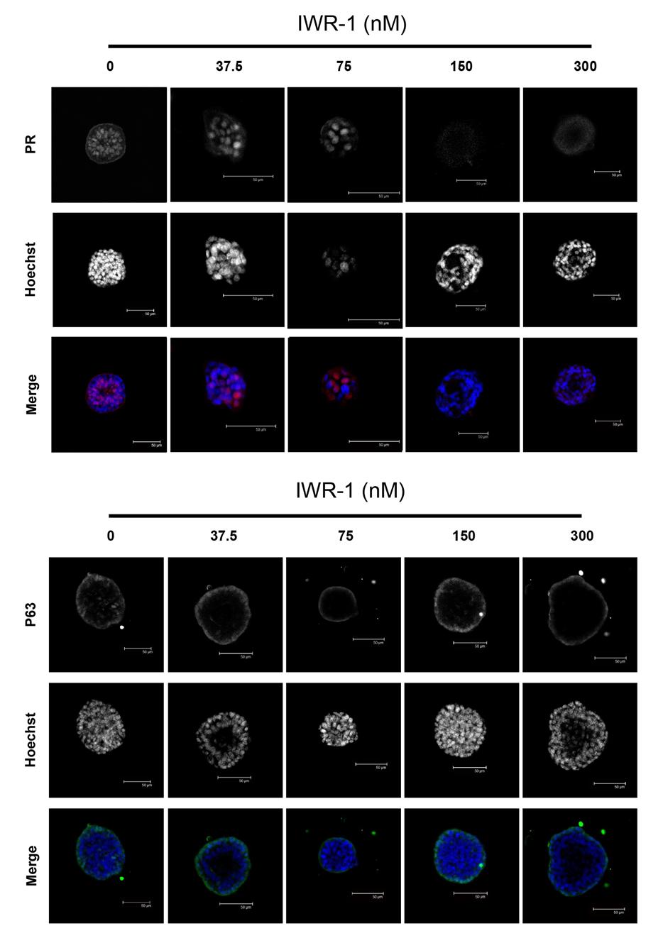 216 217 218 219 220 221 222 223 224 Supplementary Figure 22: The Wnt signalling inhibitor IWR-1 induces loss of expression of PR in mammary organoids.