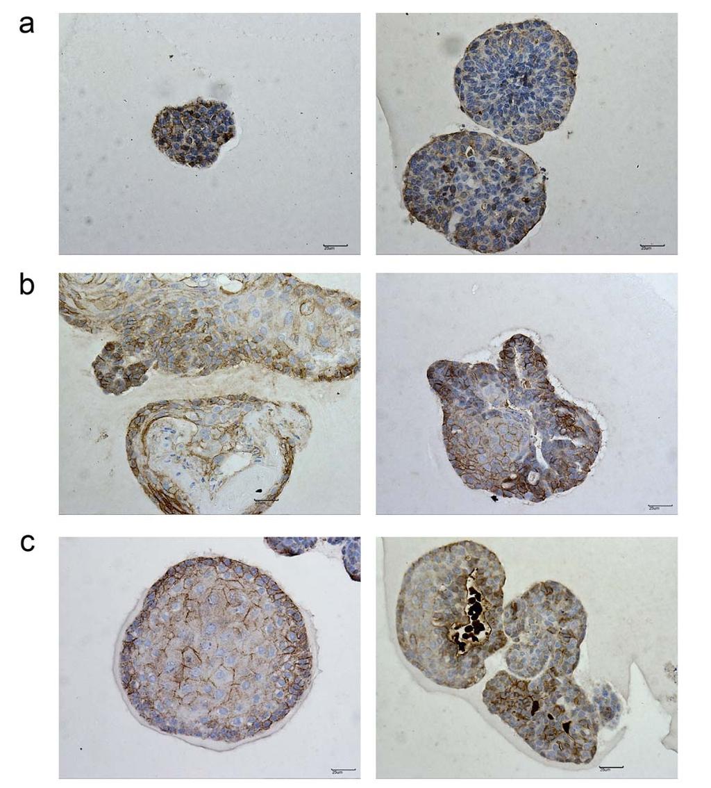 19 20 21 22 23 24 25 Supplementary Figure 3: Immunohistochemical detection of β-catenin in mammary organoids grown under Neuregulin 1 (100ng/ml) / Noggin (100ng/ml) (a),