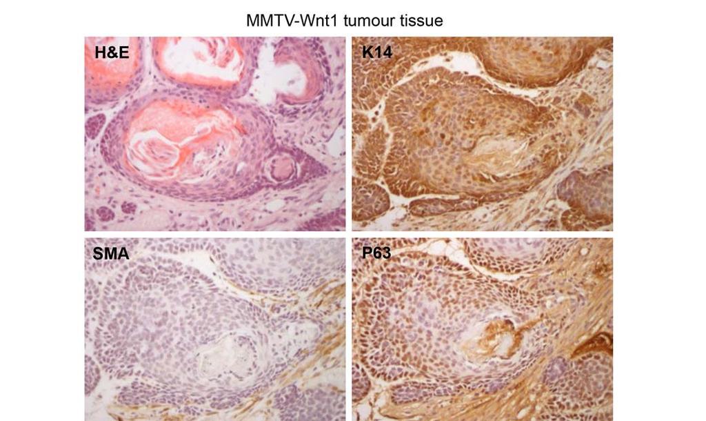 69 70 71 72 73 74 75 76 77 78 Supplementary Figure 9: R-spondin 1 treated mammary organoids recapitulate MMTV-Wnt1 tumour tissue