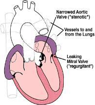 Valves Allow blood to flow in only one direction The tricuspid valve separates the right atrium and right ventricle Composed of 3 flaps The mitral valve (sometimes