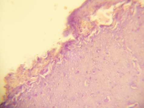 Fig. (1) Histopathological section of cerebrum of chickens in group(1) and in