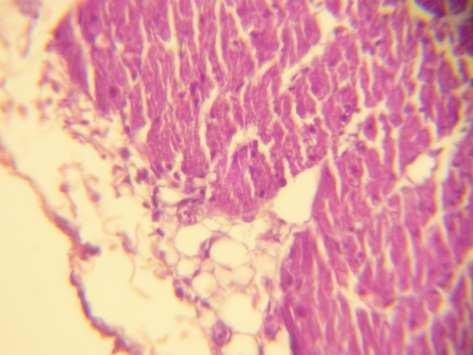 (6) Histopathological section of myocardium of hypertrophy of tunica media