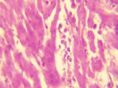(7) Histopathological section of Heart of chickens in group (1) and in group