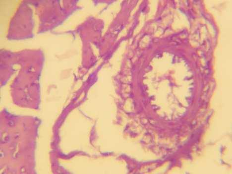 (8) Histopathological section of lung of chickens in group (1) and in group