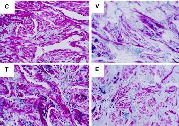 Effect of Castration and Androgen Substitution on Trabecular Smooth Muscle and Connective Tissue Content in the Corpus