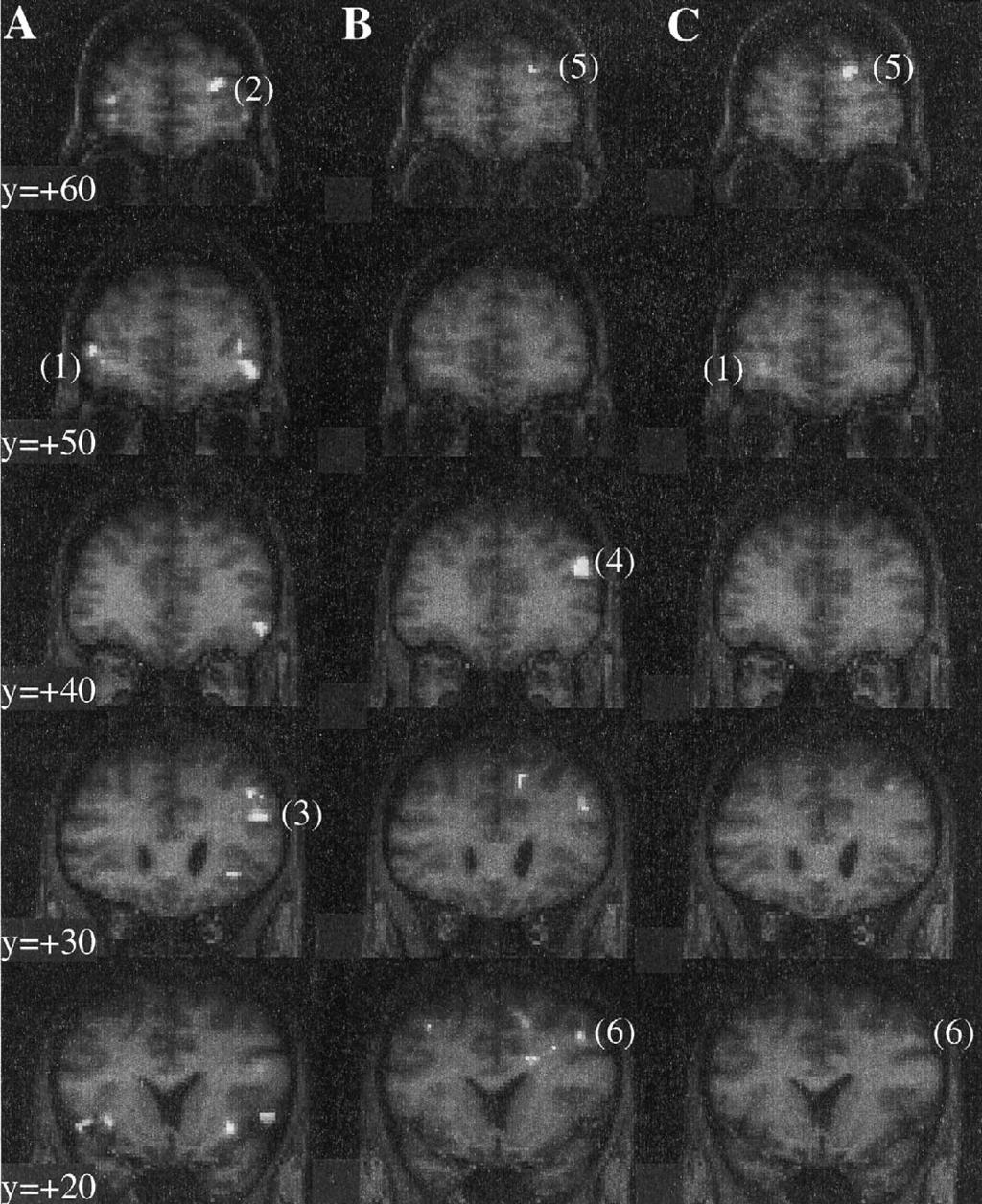M.D. Rugg et al. / Neuropsychologia 41 (20
