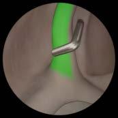 joint Guided diagnostics subacromial Healthy right shoulder Guided inspection of the