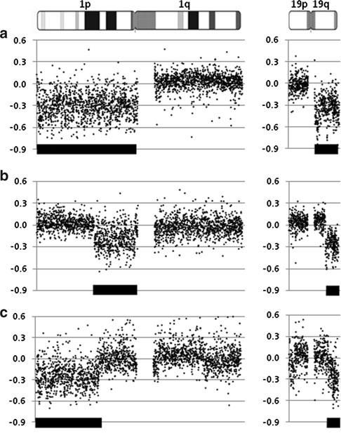 Acta Neuropathol (2010) 120:567 584 571 Fig. 2 Different types of 1p and 19q losses as detected by array- CGH.