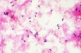 Chlamydophila pneumoniae Viral Influenza 18% of