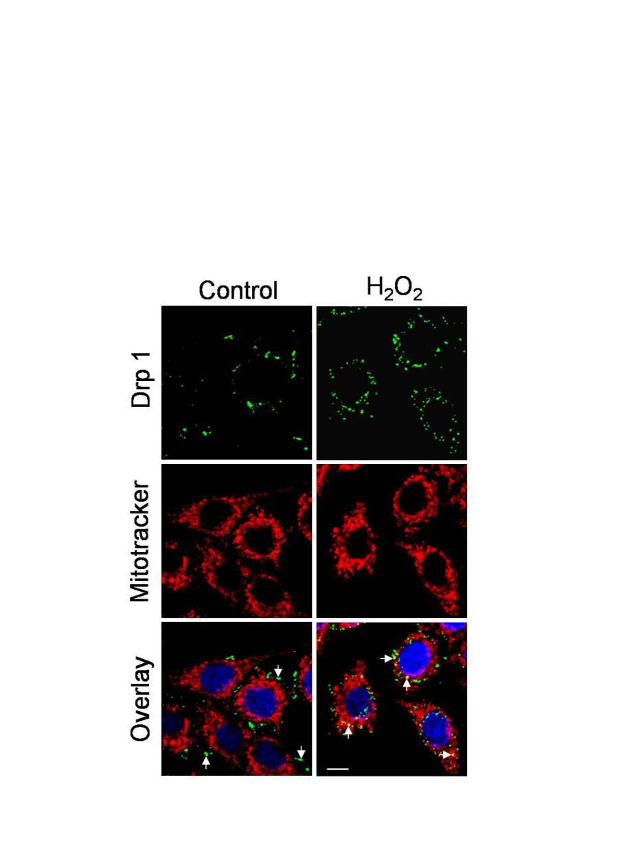 Supplementary Figure 1. Confocal immunofluorescence showing mitochondrial translocation of Drp1.