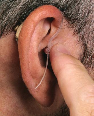 prospective user has any of the following conditions: Visible congenital or traumatic deformity of the ear. History of active drainage from the ear within the previous 90 days.