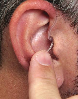 Audio metric air-bone gap equal to or greater than 15 decibels at 500 hertz (Hz), 1,000 Hz, and 2,000 Hz. Visible evidence of significant cerumen accumulation or a foreign body in the ear canal.