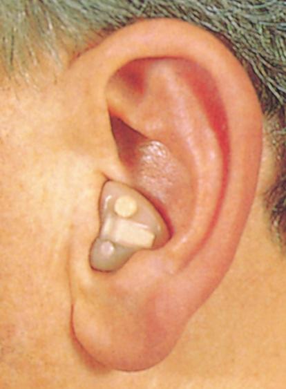 Wearing Your Custom Hearing Aid How to tell right from left: The color of the serial number located on the outside of your hearing aid will tell you.