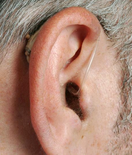 IMPORTANT NOTICE DEVICE INSERTION Good health practice requires that a person with a hearing loss have a medical evaluation by a licensed physician (preferably a physician who specializes in diseases