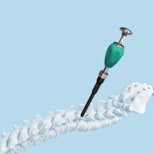 Pedicle Preparation Unscrew the trocar holder and the trocar from the pedicle awl,