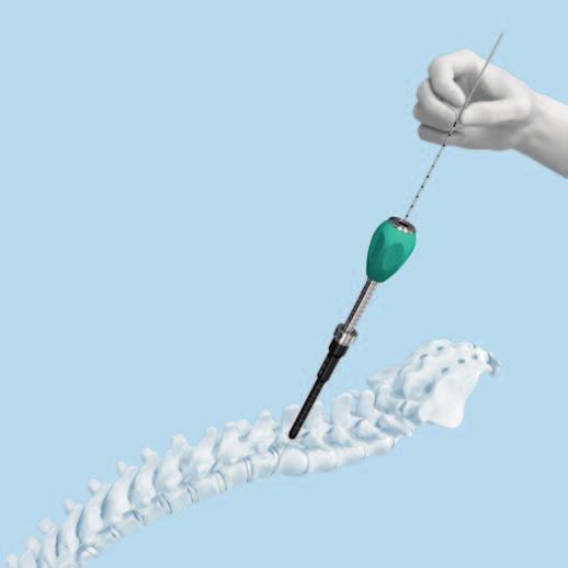 Insert a Kirschner wire into the awl and guide it through the pedicle (8). Advance the wire under fluoroscopic control to the dedicated depth where the screw is to be positioned.