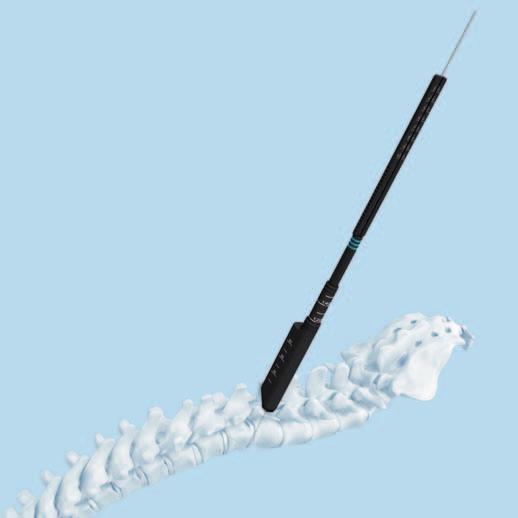 Option: Use the MIS screw length indicator for determining the screw length. 2 Note: The screw length indicator shows the depth of the Kirschner wire tip starting at the pedicle entry point.