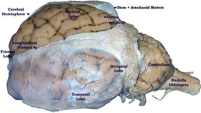 3 6. Observe the tough outer membrane (dura mater) one of the three meninges covering part or the entire brain (Fig. 7.17 in text).