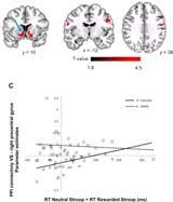 Inhibitory Control Deficits Over the Immediate Impulse for Reward in Adults with a History of Attention Deficit Hyperactivity Disorder Sample.