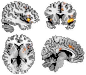 Brain Regions Active During Inhibition Brain Regions Active During Emotion