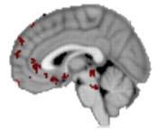 Scanning Environment Primary motor cortex (M1) Inferior Frontal Presupplementary