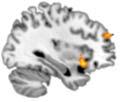 Brain Regions Active During Sustain Attention fmri Paradigms assessing Inhibitory control Insula SMA/dACC Stop Signal Task Go/NoGo Task MPFC Precuneus DLPFC IFJ Frontal Eye Fields IPL Fortenbau et al.