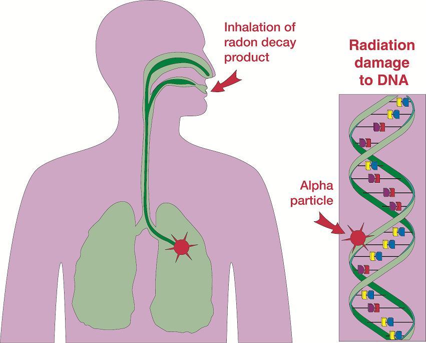Mechanism of Lung Cancer Radon and RDP s breathed in Some Radon exhaled RDP s remain stuck to lung tissue PO-218 and