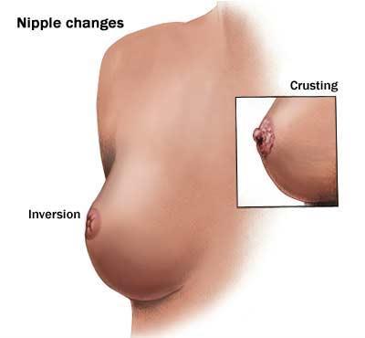 lumpiness, change with your menstrual cycle. Breast tissue also changes as you age, typically becoming more fatty and less dense.