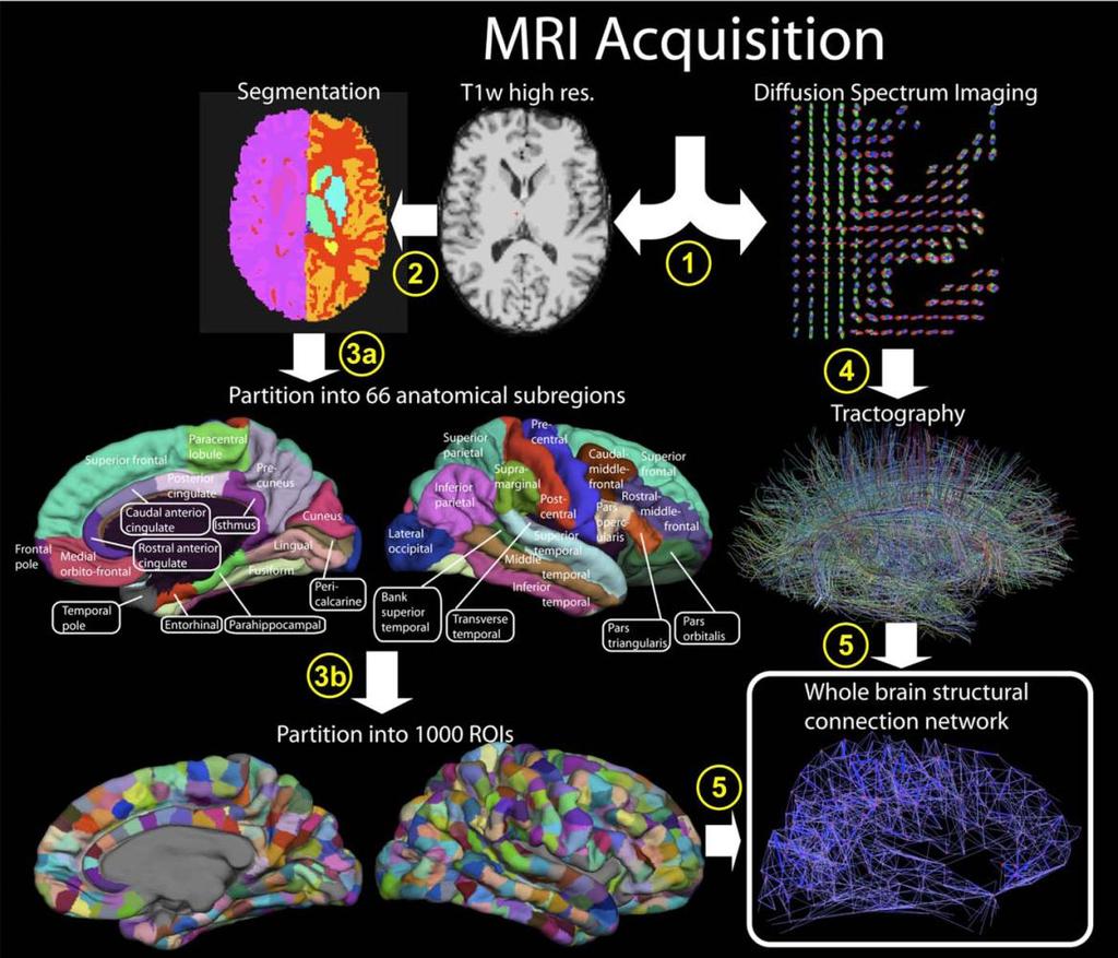Anatomical Networks The anatomical structure of Human Brain: Main results are obtained from magnetic resonance imaging Difussion Tensor Imaging (DTI) and Difussion