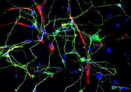 Hoechst 33258 neurons glias