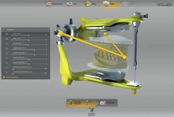Efficient support for design and function 04 I 05 NEW from inlab CAD SW 18.
