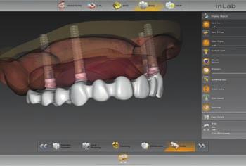 Implantology module 12 I 13 inlab CAD SW 18.