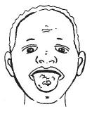 mouth Swollen glands UNIT 2 Lots of ear, throat, or