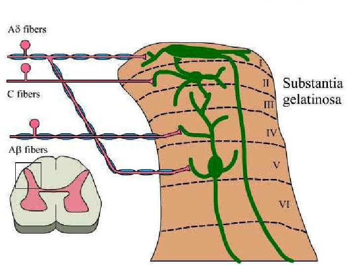 Nociceptor terminations in dorsal horn ain Mediators Cell Damage Aa K + BK Brain G Nociceptor Spinal cord