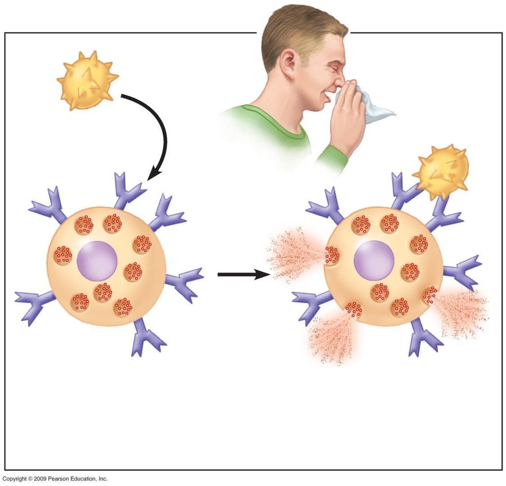 4 Allergen binds to 5 Histamine is antibodies on released,