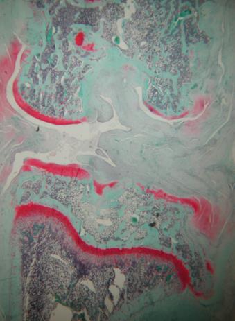 3 mg) intra-articularly Evaluate joints by histology after 12 weeks Safranin O-stained sections from the rat knee analyzed 3 months post-surgery for OA