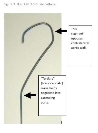 The Ikari Heartrail guide catheter series (Terumo, Tokyo, Japan) (Figure 3), with its modified shaft curvature and nontraumatic tip designs, can be utilized for diagnostic and interventional