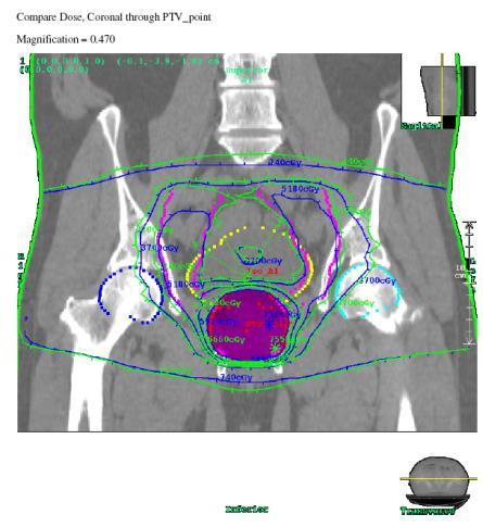 Would be routinely run off-line by radiographers similar to standard portal images, maximising machine capacity * Unique - in the fact that it measures absolute invivo dose in cgy which can be viewed