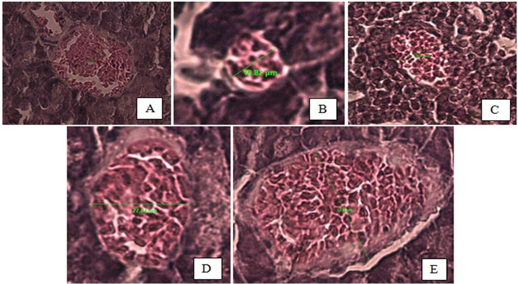 Abdulgani et al., 2014 Figure 1. Islets of Langerhansof pancreas microscopic images (1000 magnification). Descriptions: A. Negative control. Diameter 66.14 µm. B. Positive control. Diameter 10.82 µm.