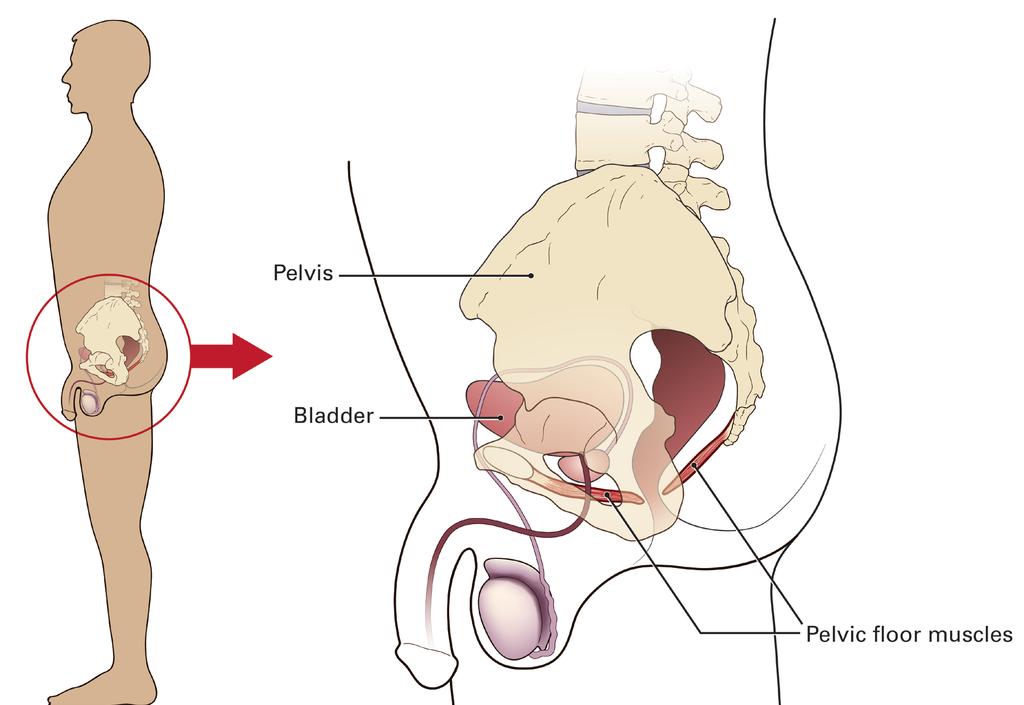 Health care professionals have been prescribing pelvic floor exercises (often called Kegel exercises) for years to treat urinary stress incontinence. Where are the pelvic floor muscles?