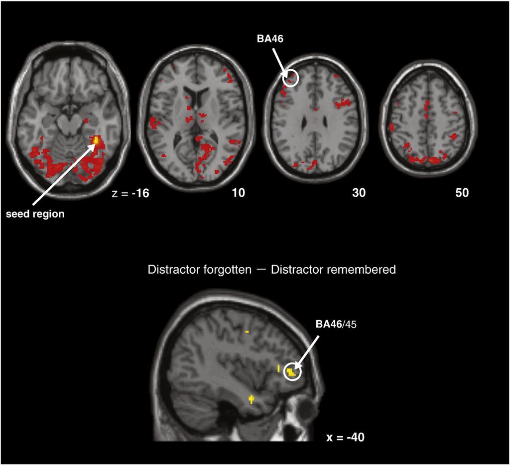 92 BRAIN RESEARCH 1429 (2012) 82 97 Fig. 8 Brain regions functionally connected with the right fusiform gyrus during distractor presentation.